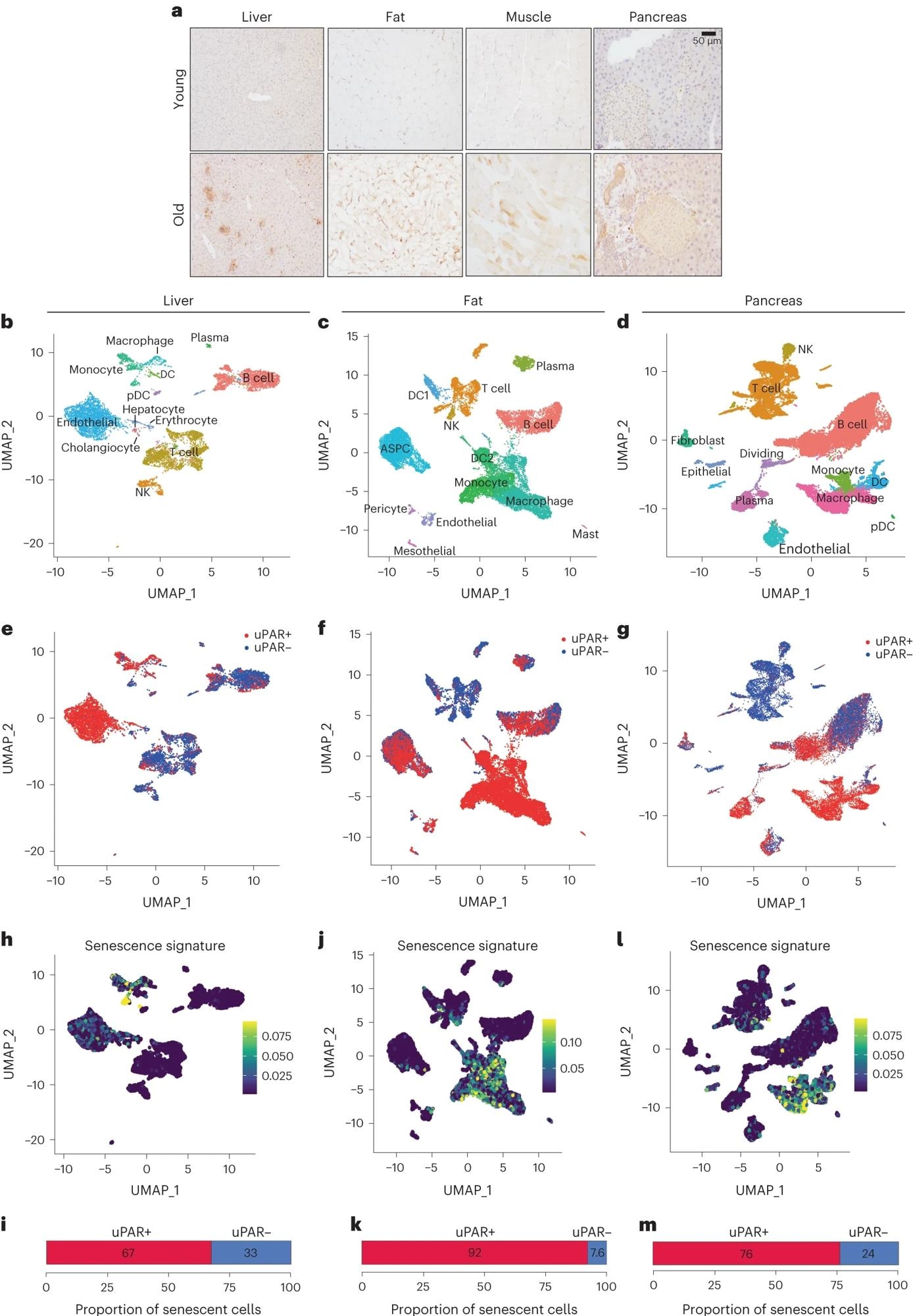 א, צביעה אימונוהיסטוכימית של uPAR עכבר בכבד, רקמות שומן, שרירים ולבלב מעכברים צעירים (גיל 3 חודשים) או מבוגרים (גיל 20 חודשים) (n = 3 לגיל).  b-m, ניתוח תא בודד של ביטוי uPAR והזדקנות.  תאים חיוביים ל-uPAR ותאים שליליים ל-uPAR מוינו מהכבד, רקמת השומן והלבלב של עכברים בני 20 חודשים ועברו ל-RNA-seq של תא יחיד לפי פרוטוקול כרום פי 10 (n = רצף של ארבעה עכברים שבהם שתי נקבות היו אוחדו לשכפול אחד ושני זכרים שולבו לשכפול אחר).  ב, הדמיה אחידה והקרנה סעפת (UMAP) של סוגי תאי כבד.  ג, הדמיית UMAP של סוגי תאי רקמת שומן.  ד, הדמיית UMAP של סוגי תאי לבלב.  ה, הדמיית UMAP של סוגי תאים uPAR שליליים ו-uPAR חיוביים בכבד.  f, הדמיית UMAP של סוגי תאים בעלי uPAR שלילי ו-uPAR חיובי.  g, הדמיית UMAP של סוגי תאים uPAR-שליליים ו-uPAR חיוביים בלבלב.  h,j,l, הדמיות UMAP עם ציוני חתימת הזדקנות 24 בכל תא המצוין בסולם הצבעים.  i,k,m, כימות של הפרופורציה של תאים uPAR חיוביים ו-uPAR שליליים התורמים לחתימת ההזדקנות המתאימה.  h,i, כבד;  j,k, רקמת שומן;  אני, מ, לבלב.  התוצאות הן מניסוי עצמאי אחד (א–מ).  DC, תא דנדריטי;  NK, רוצח טבעי;  pDC, plasmacytoid dendritic cell;  ASPC, אבות שומן ותאי גזע.