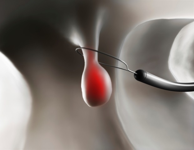 אאוץ.  בדיקה שנתית 'בחינם' זו עשויה לעלות לך.  הנה למה.