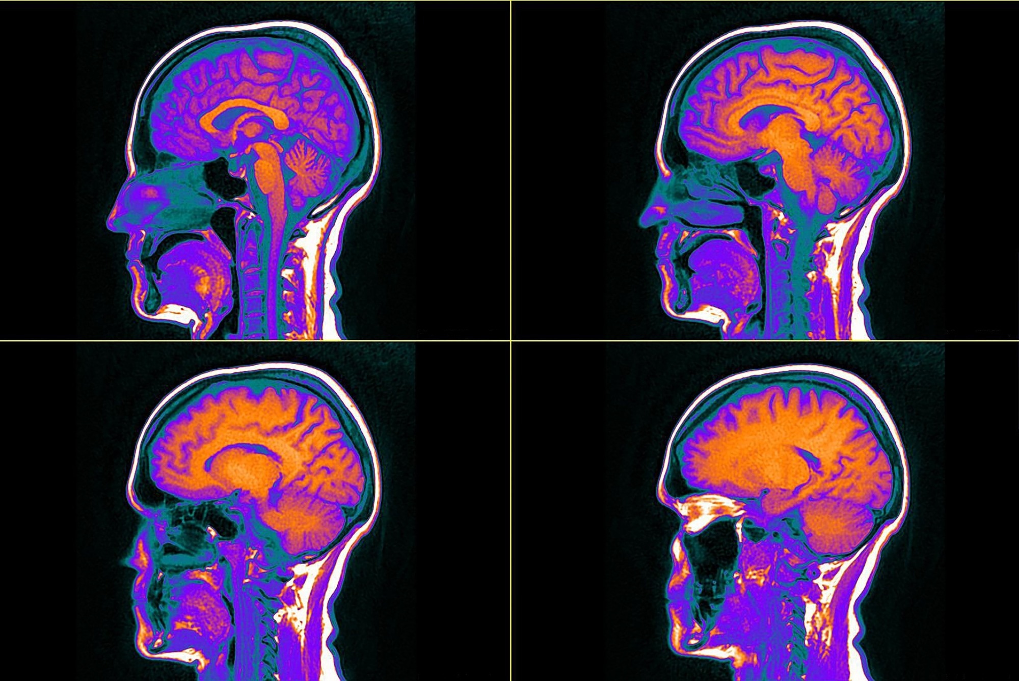 אמונות ניקוטין מעוררות תגובות מינון-תגובה במוח האנושי