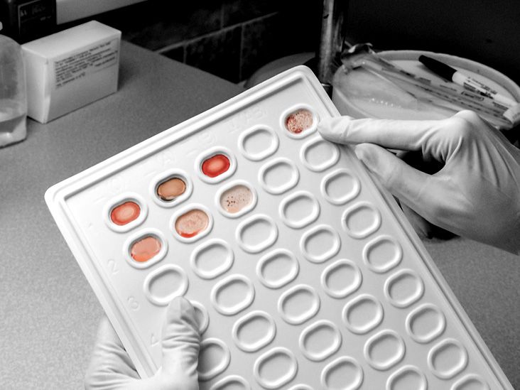 בדיקת דם חדשה מראה הבטחה באיתור 18 סוגי סרטן