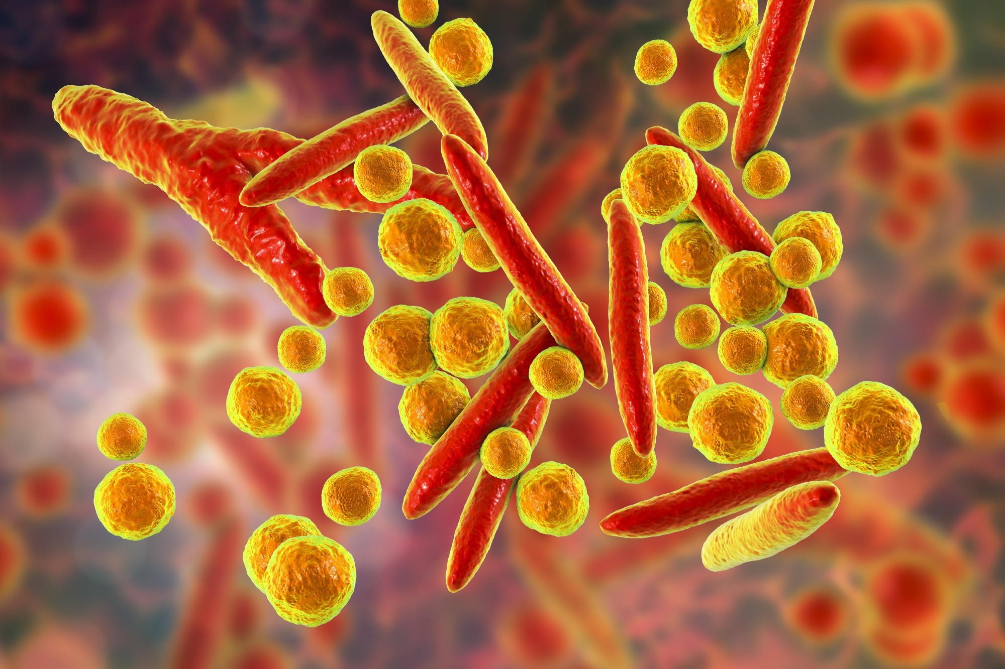 Study: Increased incidence of Mycoplasma pneumoniae infections and hospital admissions in the Netherlands, November to December 2023. Image Credit: Kateryna Kon / Shutterstock