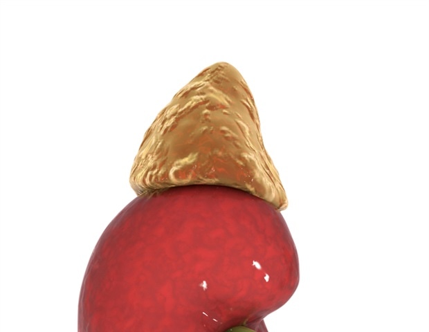 גישת הדמיה חדשנית מזהה במדויק תת-סוגים של אלדוסטרוניזם ראשוני