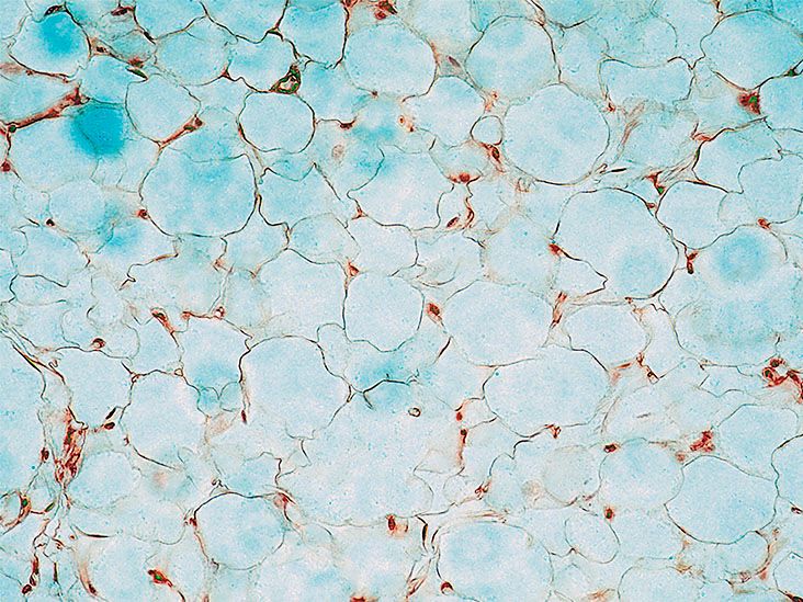 השמנת יתר הנגרמת על ידי מולקולה משבשת חילוף חומרים, מגלה מחקר