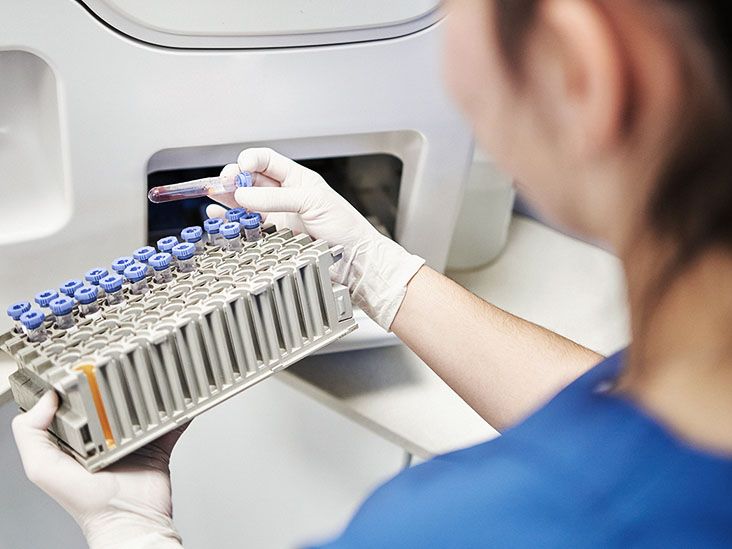 השמנת יתר קשורה למבשר לסרטן דם מיאלומה נפוצה