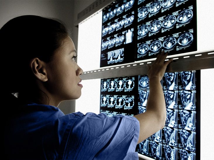 ייתכן שאלצהיימר הועברה בהליך רפואי שאינו בשימוש עוד: מה לדעת