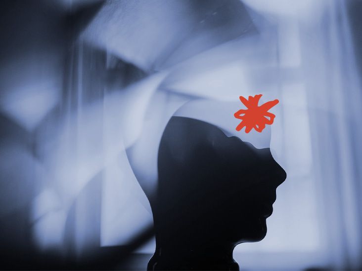 כיצד שנת לילה גרועה עלולה לעורר כאבי ראש מיגרנה