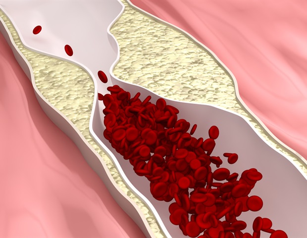מודל גיליון כלי דם ננומטרי תלת מימדי לבדיקת תרופות טרשת עורקים בתפוקה גבוהה