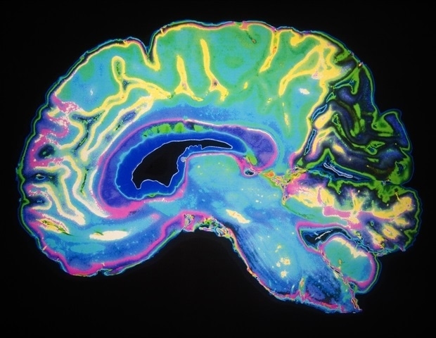 מיני-איברים תלת-ממדיים מרקמת מוח עוברית אנושית פותחים חזית חדשה בחקר המוח