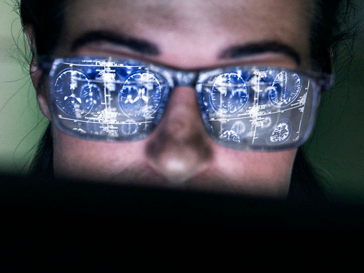 עד כמה גירוי מוחי עמוק יכול לעזור לאנשים עם מחלת פרקינסון