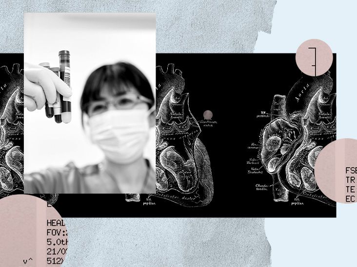 בדיקת דם פשוטה עשויה לחזות את הסיכון להתקף לב תוך 6 חודשים