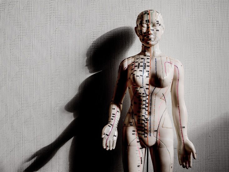 דיקור סיני עשוי לסייע בהפחתת הסיכון לשבץ אצל אנשים עם דלקת מפרקים שגרונית