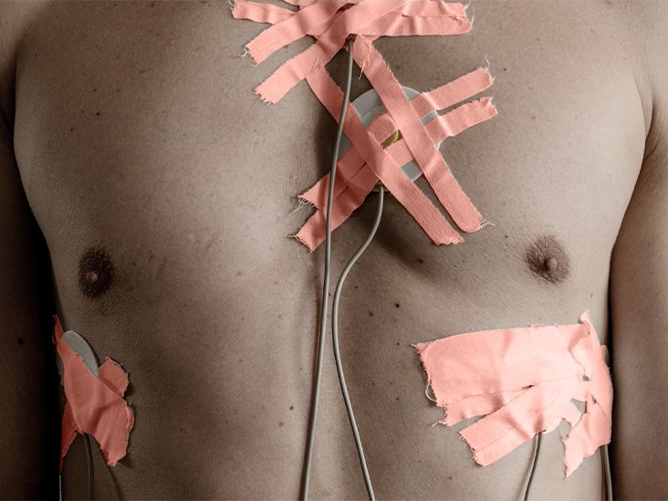 למי יש סיכוי גבוה לפתח מחלת עורקים כליליים?