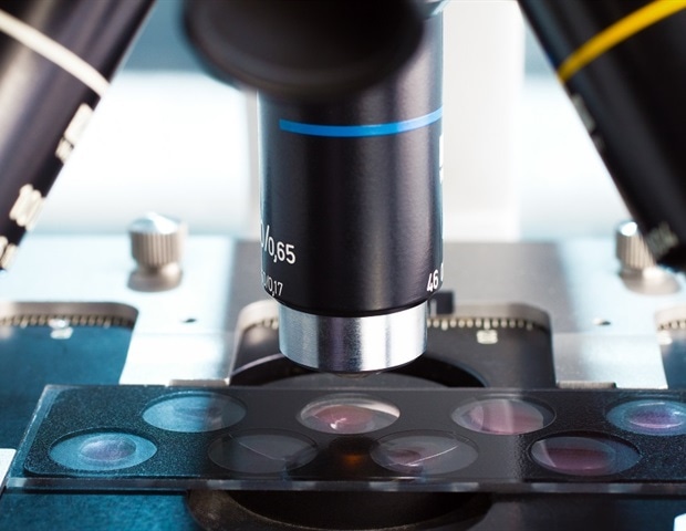 מיקרוסקופיה מהפכה עם טכניקות ברזולוציה גבוהה במחירים נוחים