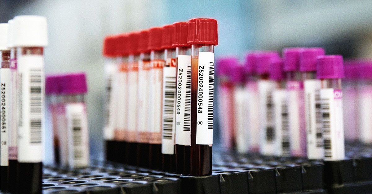 בדיקת דם חדשה מראה הבטחה מסוימת בגילוי סרטן המעי הגס