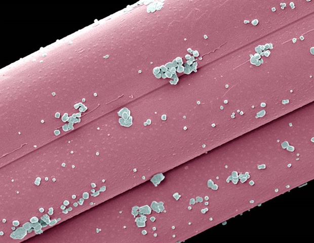 "ננו-חלקיק GPS" חדש נותן אגרוף גנטי לחלבון המעורב בהתפשטות הגידול