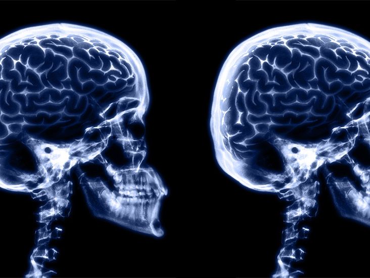 רמות גלוקוז גבוהות מדי או נמוכות מדי עלולות להאט את הקוגניציה אצל אנשים עם סוכרת מסוג 1