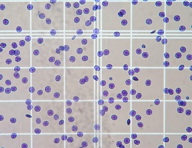 מהפכה בספירת הפטוציטים עבור חוקרים