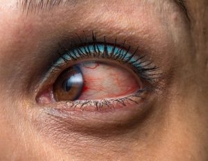 הדמיה באמצעות אוטופלואורסצנציה של קרקעית הקרקע יכולה להקל על האבחנה והניטור של מחלות עיניים נדירות