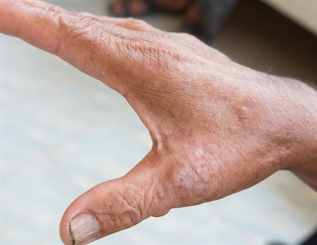 כיצד Cedars-Sinai משפרת ללא הרף את האינטראקציות של המטופלים מהצ'ק-אין ועד לשחרור