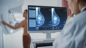 Study: Real world study of sacituzumab govitecan in metastatic triple-negative breast cancer in the United Kingdom. Image Credit: Gorodenkoff/Shutterstock.com