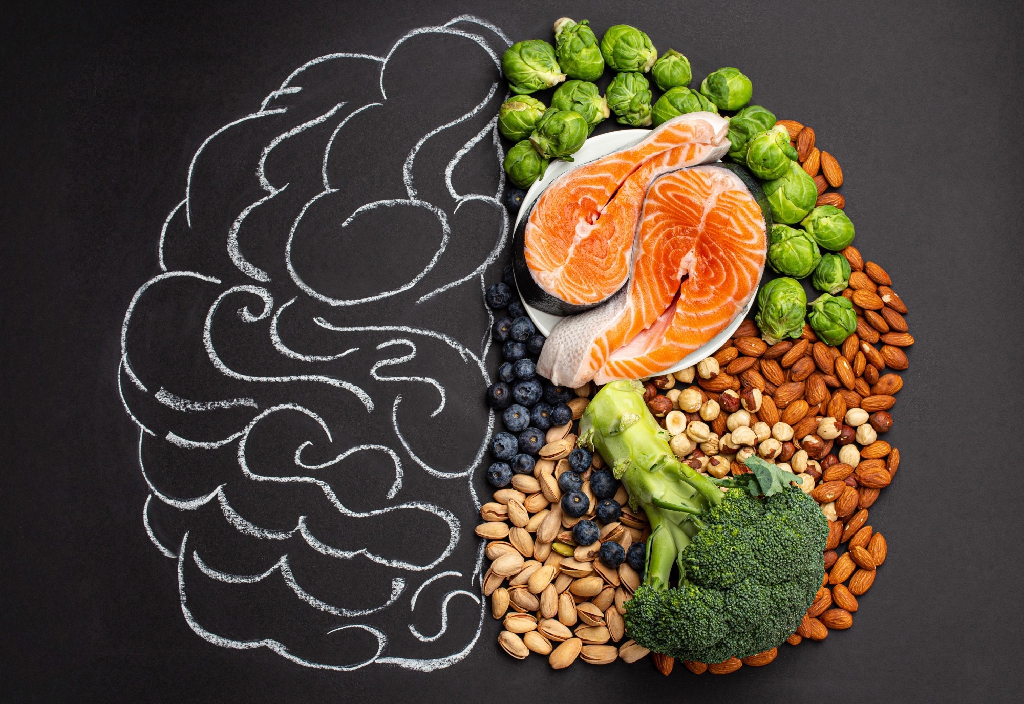 Study: Associations of dietary patterns with brain health from behavioral, neuroimaging, biochemical and genetic analyses. Image Credit: Elena Eryomenko / Shutterstock
