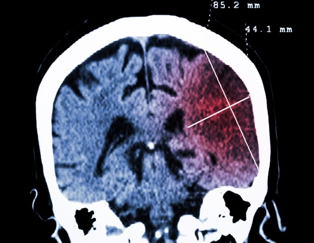 גנים המשפיעים על התנהגות תולעים נמצאו רלוונטיים למחלות נוירולוגיות בבני אדם