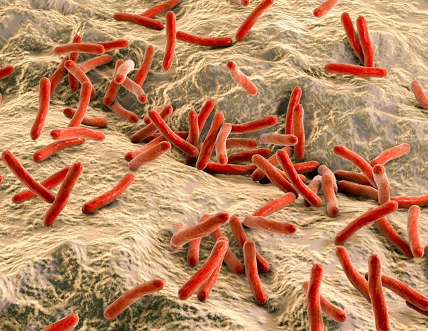 האם זה מפיץ צרעת בפלורידה?