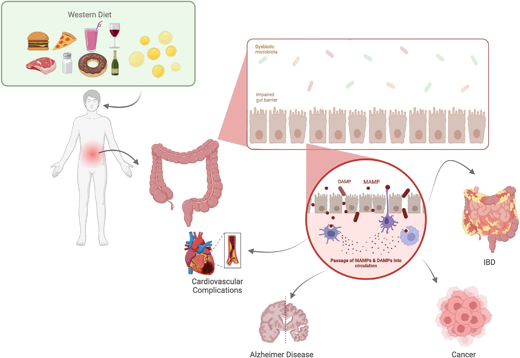 Study: The microbiome-driven impact of Western diet in the development of noncommunicable chronic disorders