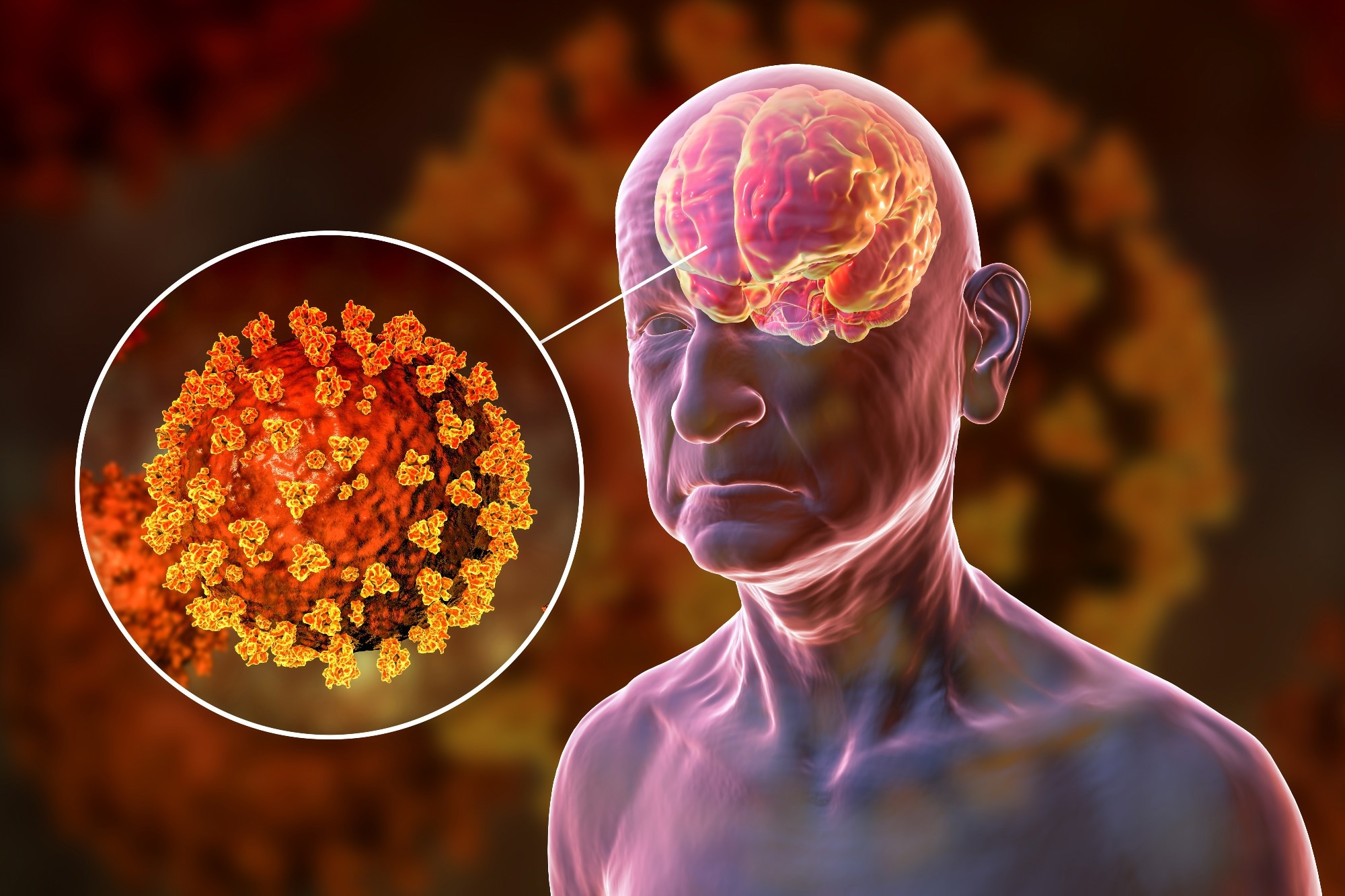 Study: Short- and long-term neuropsychiatric outcomes in long COVID in South Korea and Japan. Image Credit: Kateryna Kon / Shutterstock