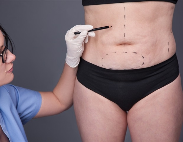 סוג ניתוח הרזיה לפני ההריון עשוי להשפיע על העלייה המוקדמת של הילד במשקל