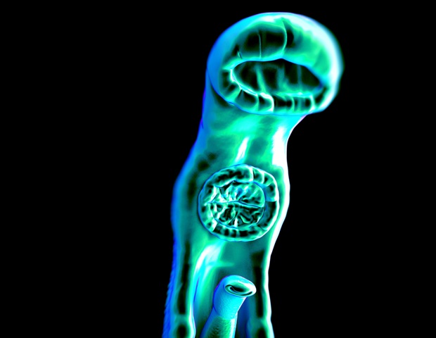 סכיסטוזומים היברידיים מבקר מסבכים את השליטה במחלות אנושיות