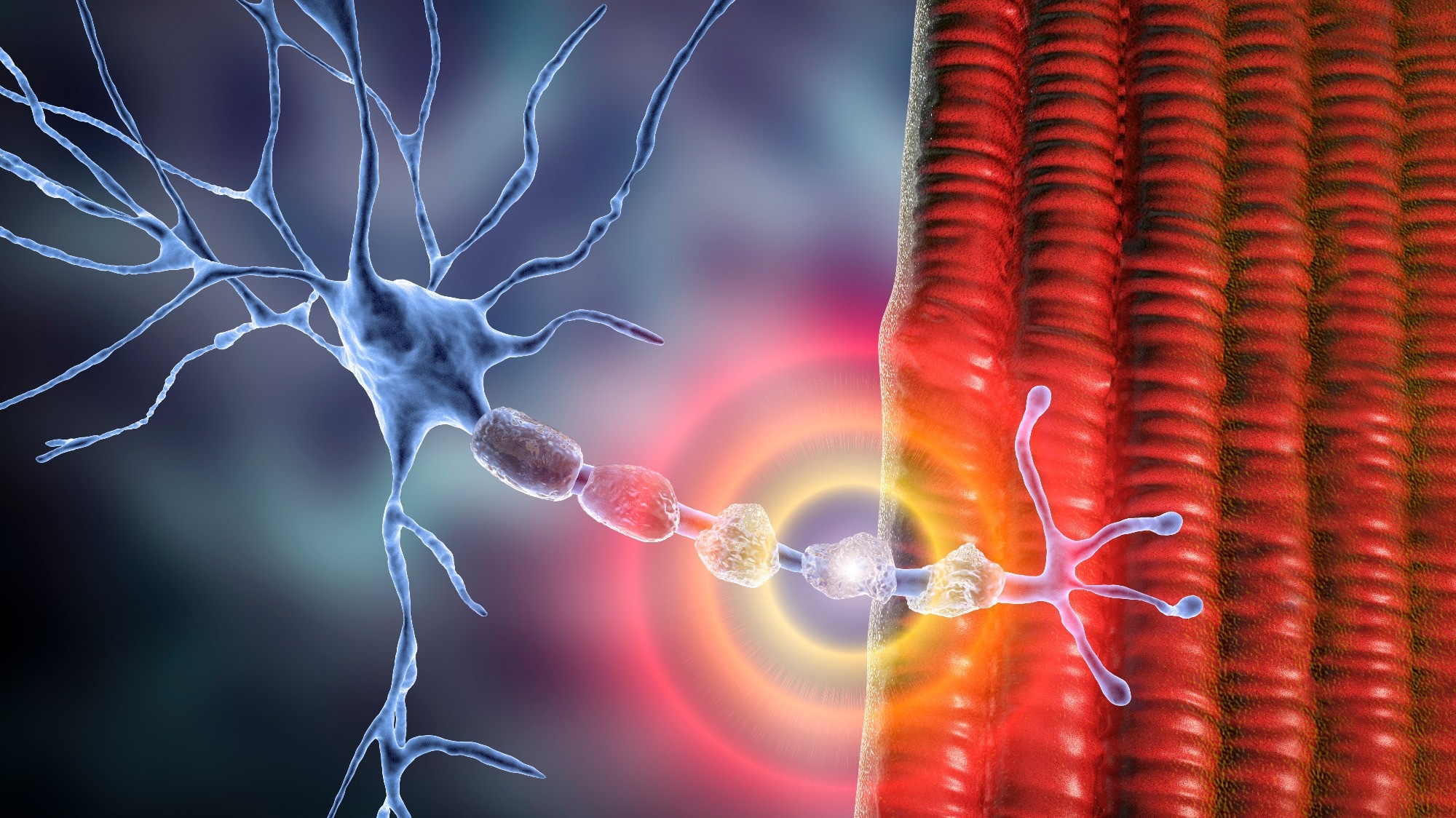 Demyelination of neuron, the damage of the neuron myelin sheath seen in demyelinating diseases. Image Credit: Kateryna Kon / Shutterstock
