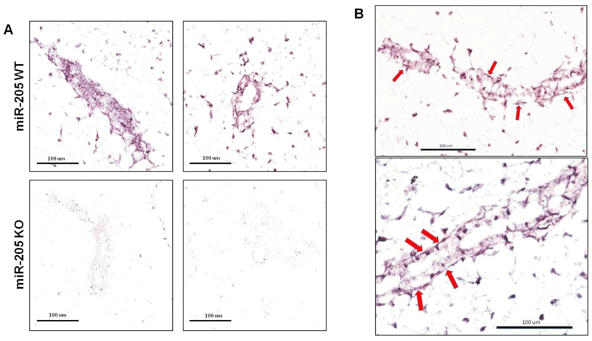 אובדן גנטי של miR-205 מגביר את התפתחות בלוטת החלב בעכברים, חושף תובנות חדשות לגבי דיכוי סרטן השד
