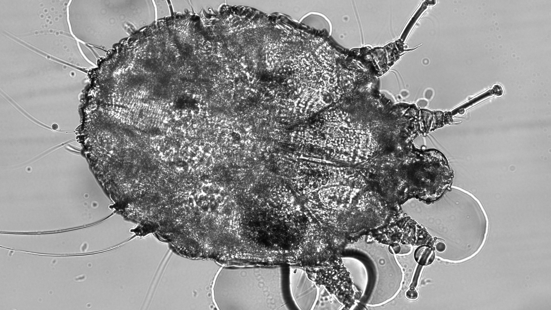 סרקופטה של ​​גרדת אנושית שנראתה תחת מיקרוסקופ אופטי (x20)