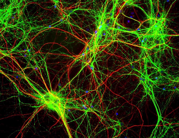 מודל בעלי חיים שופך אור על התפקיד של איבר המוח שלא נחקר בתיקון נזקי שבץ