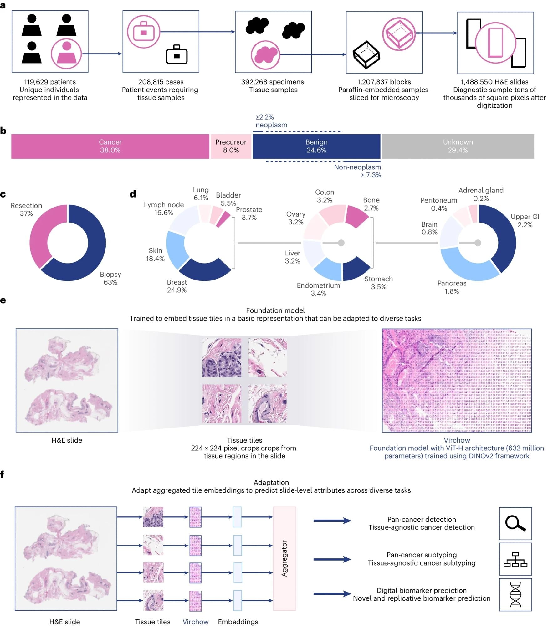 The training dataset, training algorithm and application of Virchow, a foundation model for computational pathology. a, The training data can be described in terms of patients, cases, specimens, blocks or slides, as shown. b–d, The slide distribution as a function of cancer status (b), surgery (c) and tissue type (d). e, The dataflow during training requires processing the slide into tiles, which are then cropped into global and local views. f, Schematic of applications of the foundation model using an aggregator model to predict attributes at the slide level. GI, gastrointestinal. Study: A foundation model for clinical-grade computational pathology and rare cancers detection