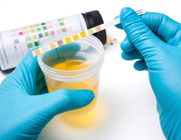 מחקר UCSF חושף הכפלה של פציעות ואשפוזים מכלי רכב ניידים