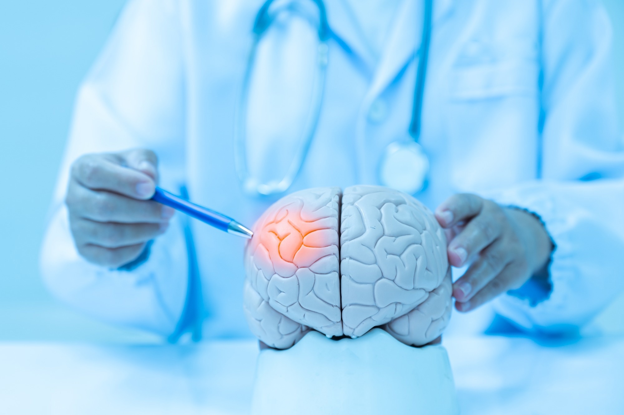 ​​​​​​​Study: Cognitive function in adolescence and the risk of early-onset stroke. Image Credit: Komsan Loonprom/Shutterstock.com