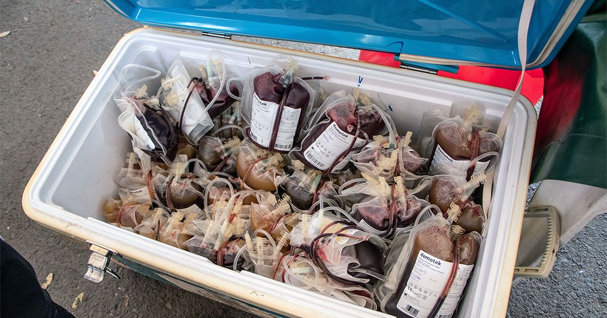 בדיקת דם יכולה לנבא סוכרת, מחלת כליות, אלצהיימר, מחלות אחרות הקשורות לגיל