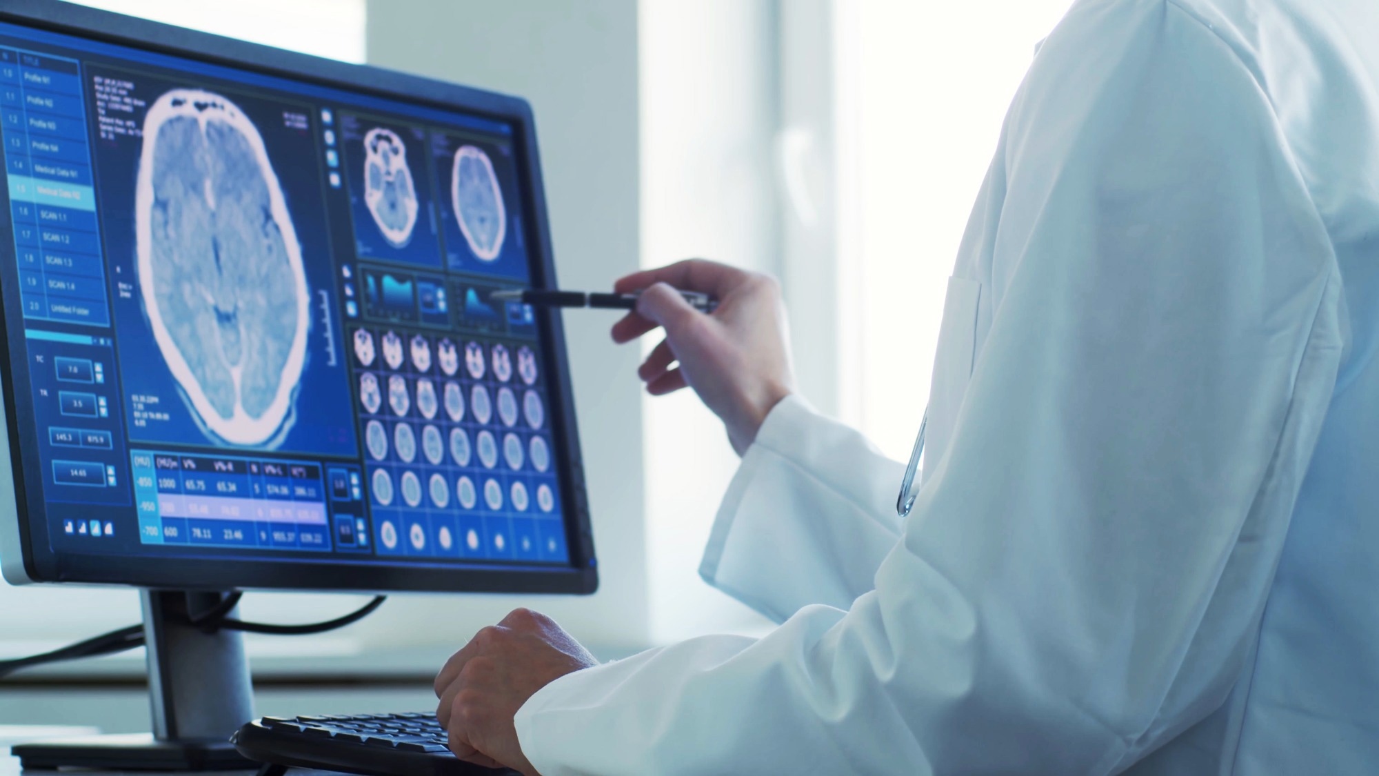 גירוי מוחי עמוק אדפטיבי מונע בינה מלאכותית משפר את תסמיני פרקינסון