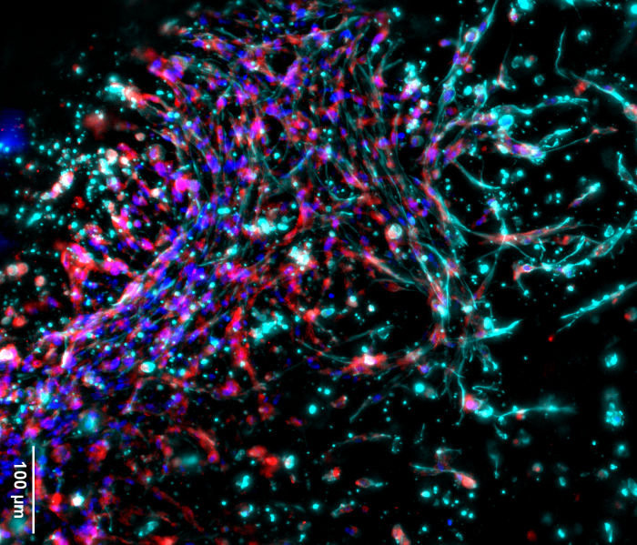 קרצינוטק שולט בעונת פרסי הקיץ