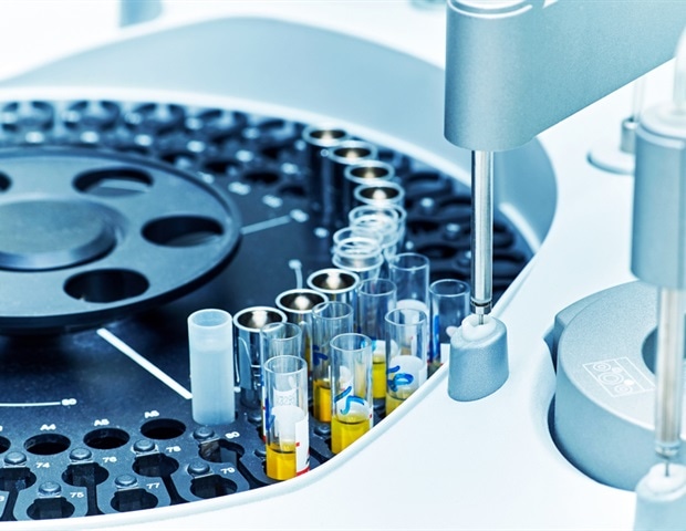 שותפות אסטרטגית לחולל מהפכה בבדיקות שתן