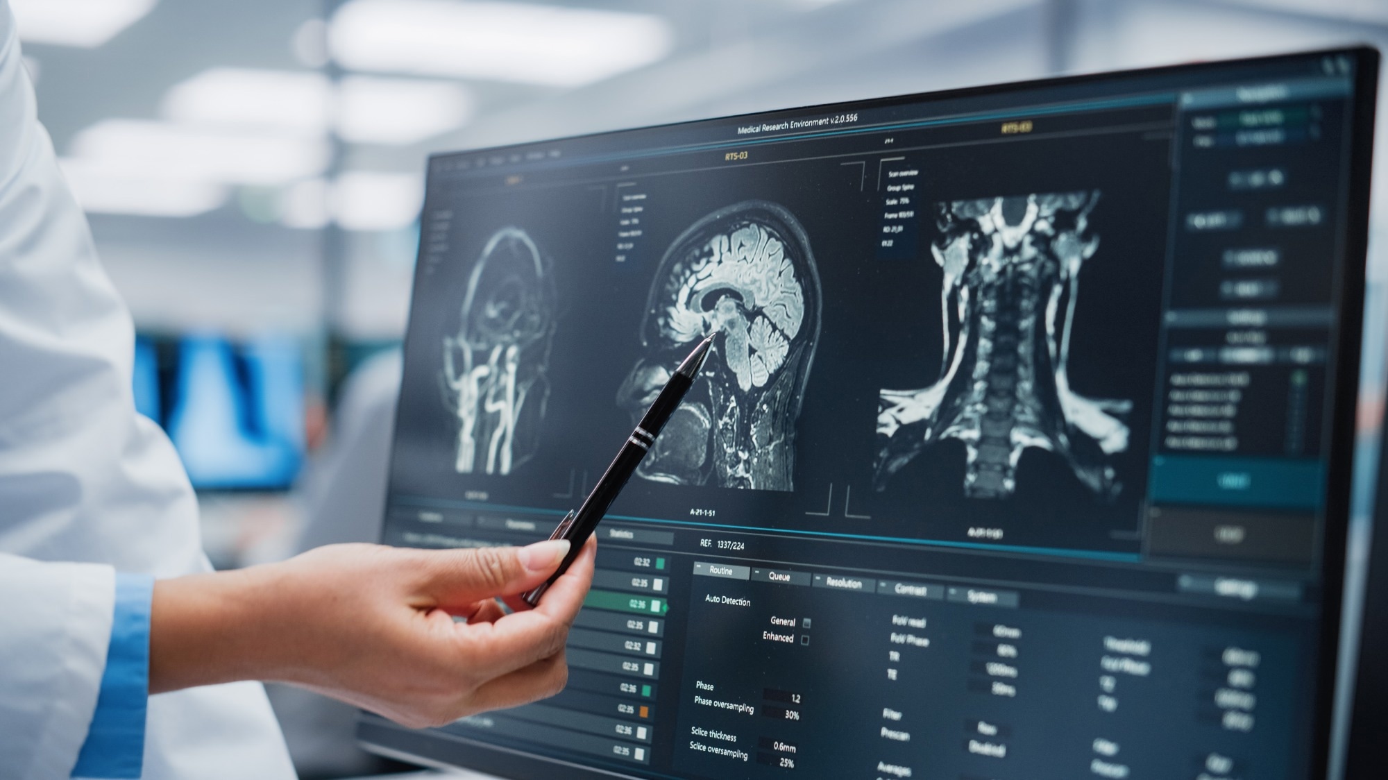 Study: Post-hospitalisation COVID-19 cognitive deficits at one year are global and associated with elevated brain injury markers and grey matter volume reduction. Image Credit: Gorodenkoff / Shutterstock