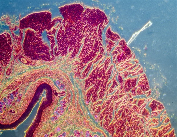 NIAID מעניק מענקים עבור 10 פרויקטים לשיפור כלי אבחון עבור עגבת