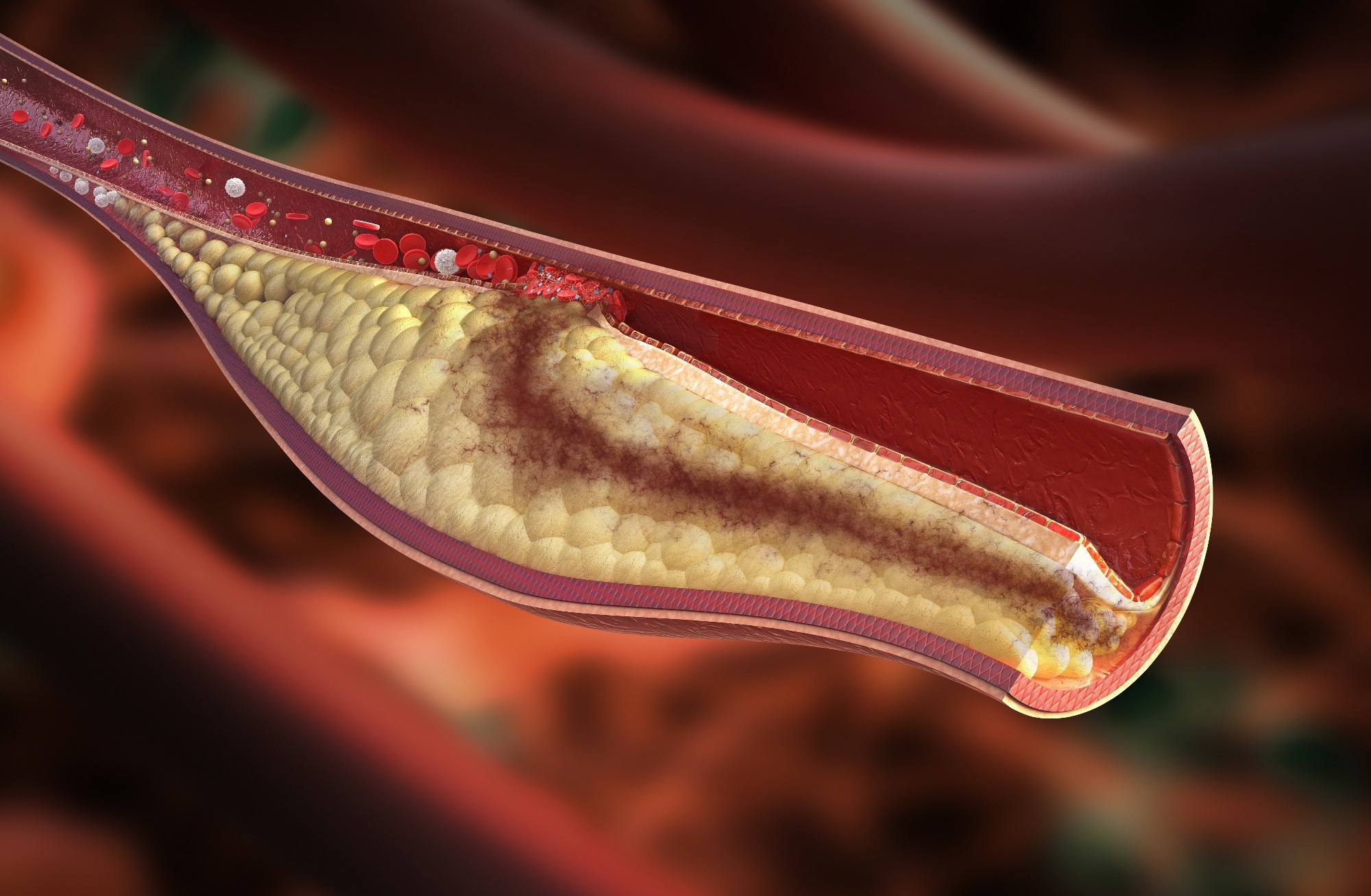 Study: Association between the atherogenic index of plasma and erectile dysfunction in US men: a population-based cross-sectional study. Image Credit: Rocos / Shutterstock