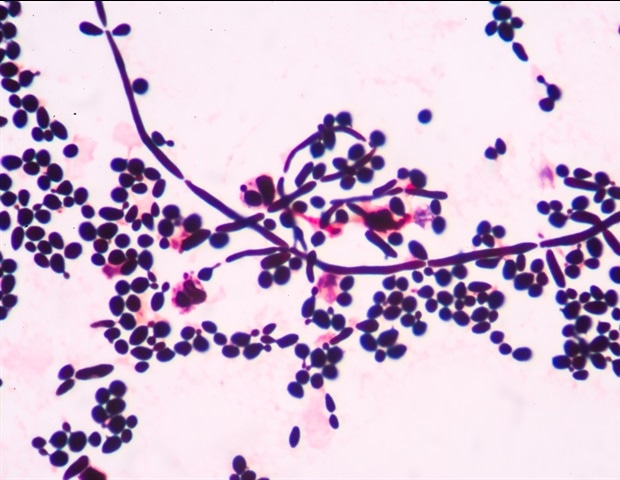 הבנת מנגנוני הגמטוגנזה בשמרים ניצנים