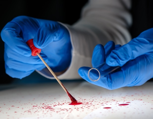 טכניקה חדשה מבטיחה ניתוח DNA מהיר יותר במקרים של תקיפה מינית