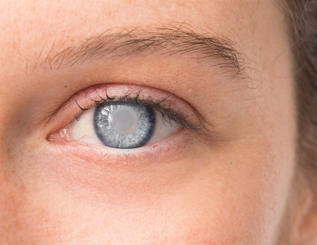 מחקר עשוי לייצג אסטרטגיה אפשרית ללא ניתוח לניהול קטרקט