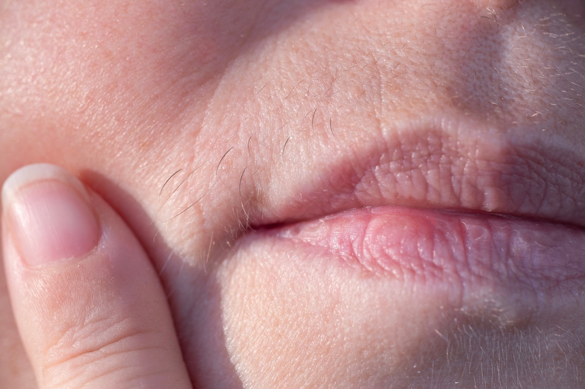 Study: Unveiling the shared genetic architecture between testosterone and polycystic ovary syndrome. Image Credit: Kittyfly/Shutterstock.com