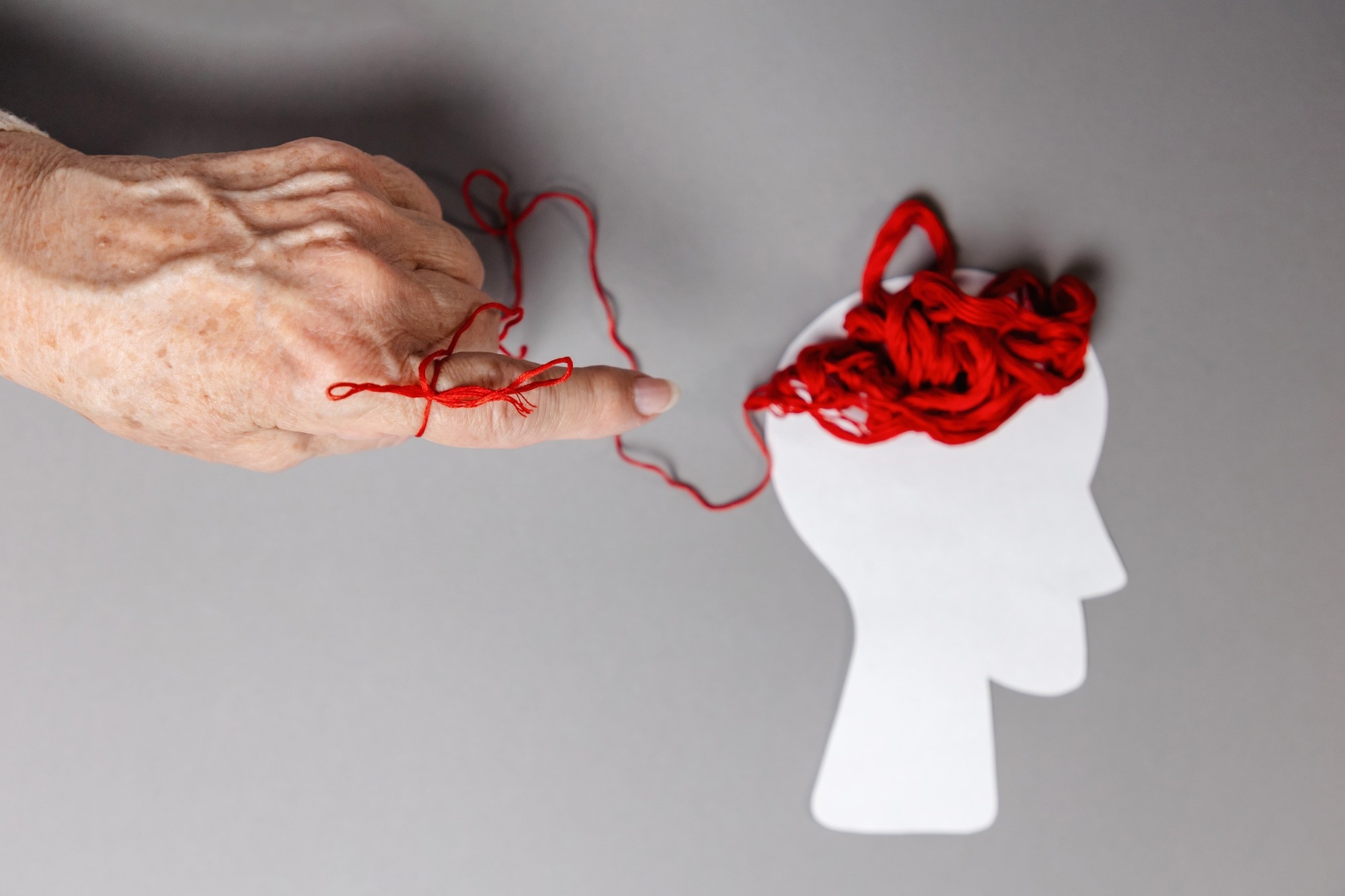 Study: Prediction and clustering of Alzheimer’s disease by race and sex: a multi-head deep-learning approach to analyze irregular and heterogeneous data. Image Credit: STEKLO / Shutterstock